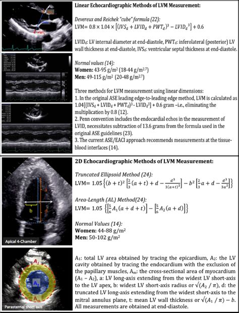 lv index|Approaches to Echocardiographic Assessment of Left .